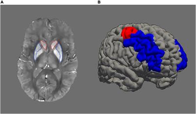 Contributions of the Catechol-O-Methyltransferase Val158Met Polymorphism to Changes in Brain Iron Across Adulthood and Their Relationships to Working Memory